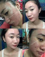 Fairy Skin Facial Derma set