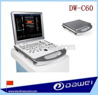 Portable Color Doppler Ultrasound Machine Laptop