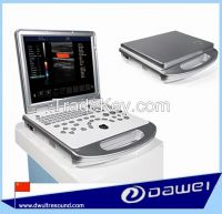laptop portable color doppler ultrasound machine