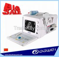 ultrasound machine for pregnancy DW3101A