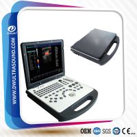 laptop color doppler ultrasound scanner