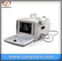 CE U645 Full Digital PC Potable Ultrasound Machine for Pregnancy