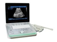 SS-9 PC Based Laptop Ultrasound B scanner