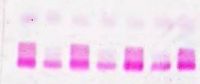 LIPOPPROTEIN ELECTROPHORESIS (LE)