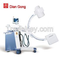 medical c arm x ray system prices | Mobile C-arm x ray machine