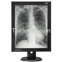3 MegaPixel high resolution medical display