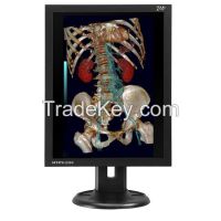 2MP medical X-RAY LCD display monitors
