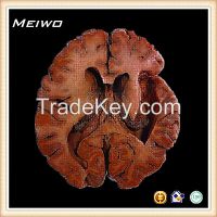 Lateral ventricles plastinated specimen supplier