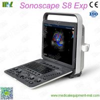 Factory Direct Sales Best Sonoscape Ultrasound Machine S8exp